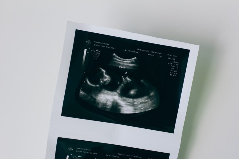 photo of sonogram used in a pregnancy journal