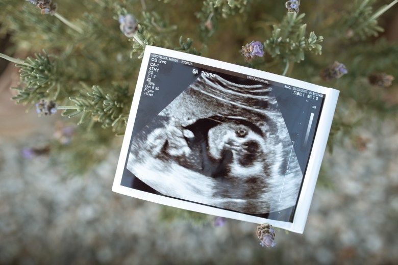 An ultrasound photo used in a pregnancy journal